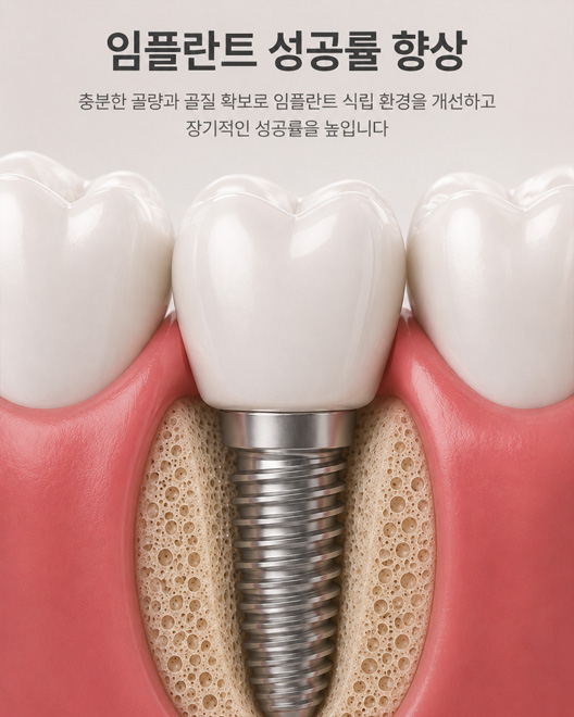 심미적 결과 유지